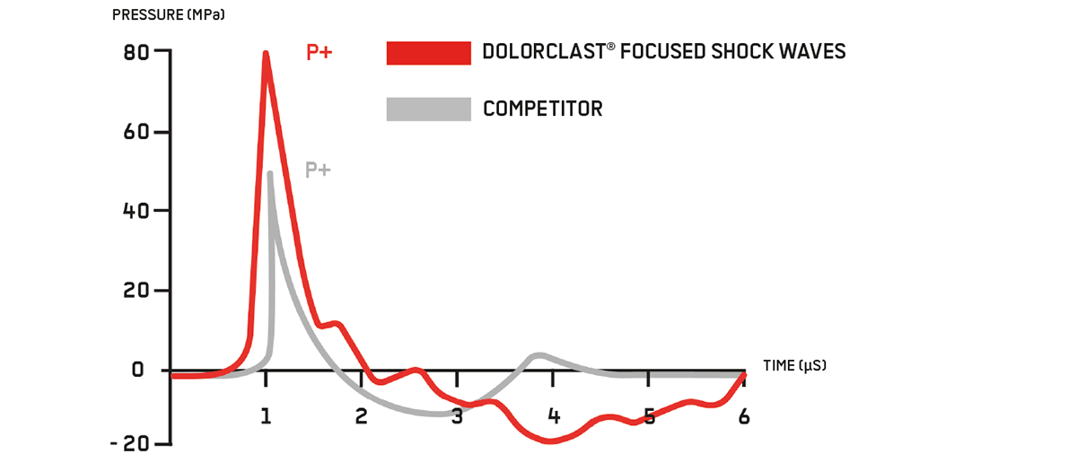 dolorclast focused shock waves usa graph